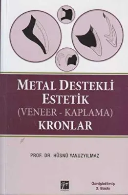 Metal Destekli Estetik Veneer-KaplamaKronlar