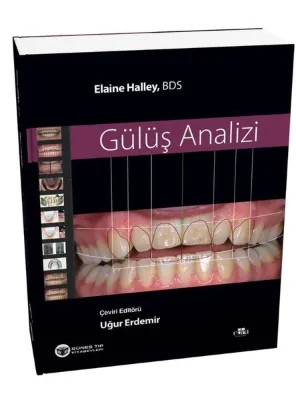 Gülüş Analizi